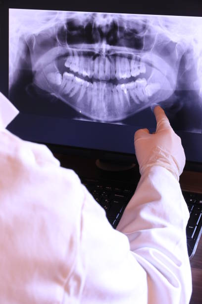 Best Emergency Tooth Extraction in Greene, IA